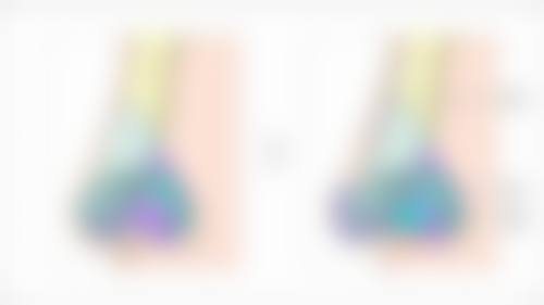 玻尿酸纳注射关节一般打几次