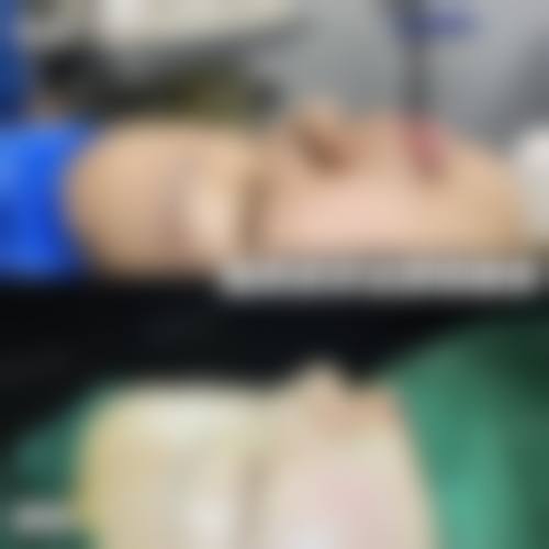 【合肥洛菲医疗美容整形门诊部参考价格表：】