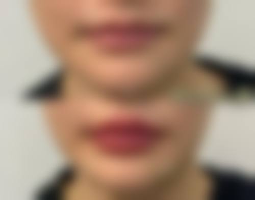 【丹阳薇塔贝拉医疗美容诊所怎么预约挂号?】