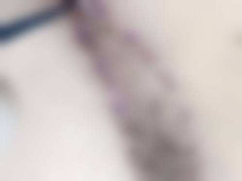 爱美者可以通过医院的法定网站或电话进行预约。医院提供体贴的服务，当你预约成功后，医院会安排专精的医护人员为你进行充分的检查和详细的询问，让你在就诊前对自己的情况和手术方案有更清晰的了解，确保整个就诊过程顺利进行。