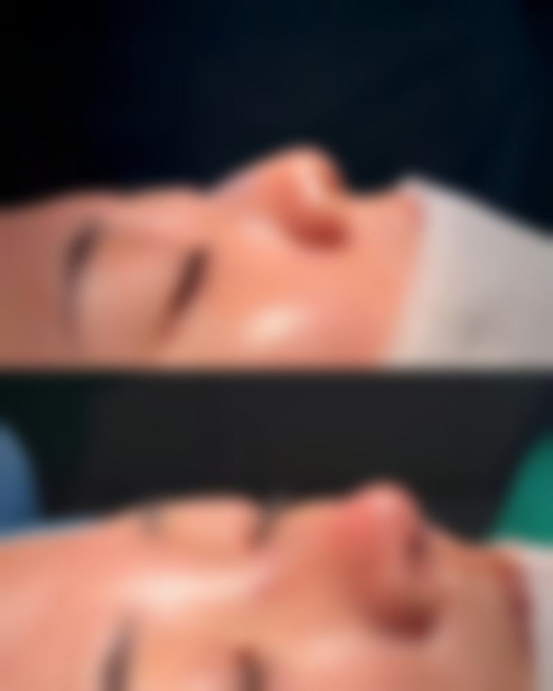 国字脸适合打苹果肌吗