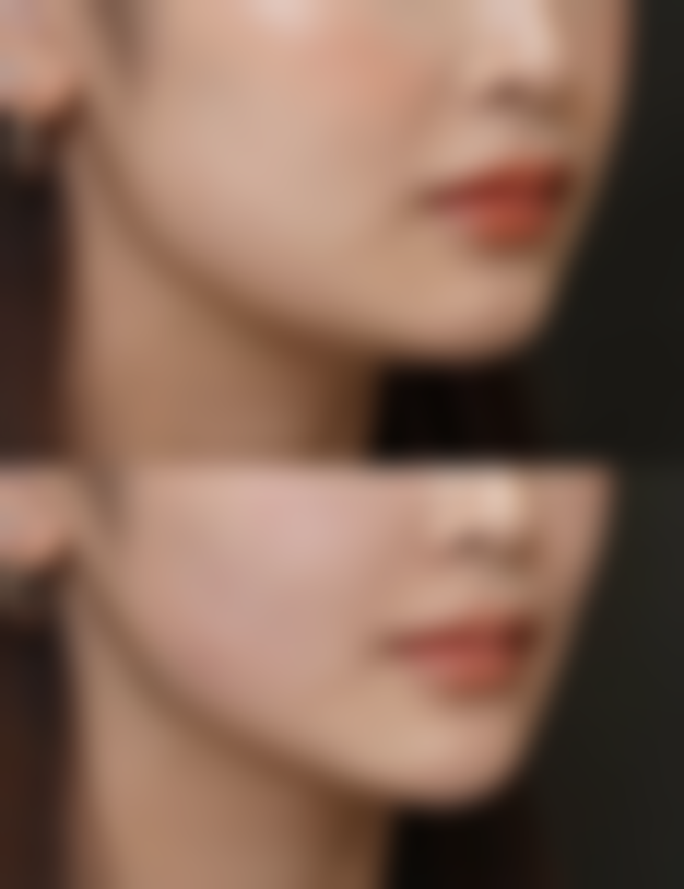 韩国除皱针品牌有哪几款？揭秘5大热门品牌优势，助你轻松对抗皱纹重拾青春光彩！ 