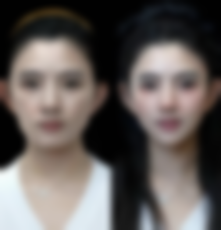 关于“50岁可以做包茎环切术吗”的视频讲解