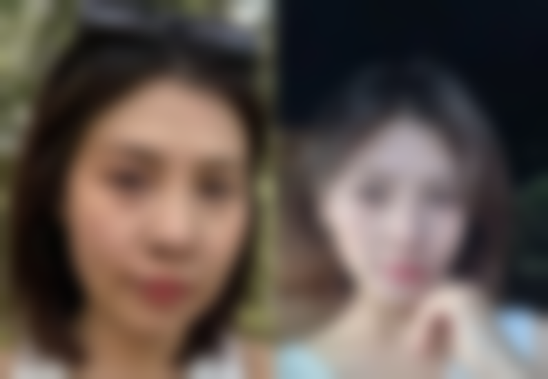 国字脸可以打瘦脸针吗瘦下来吗