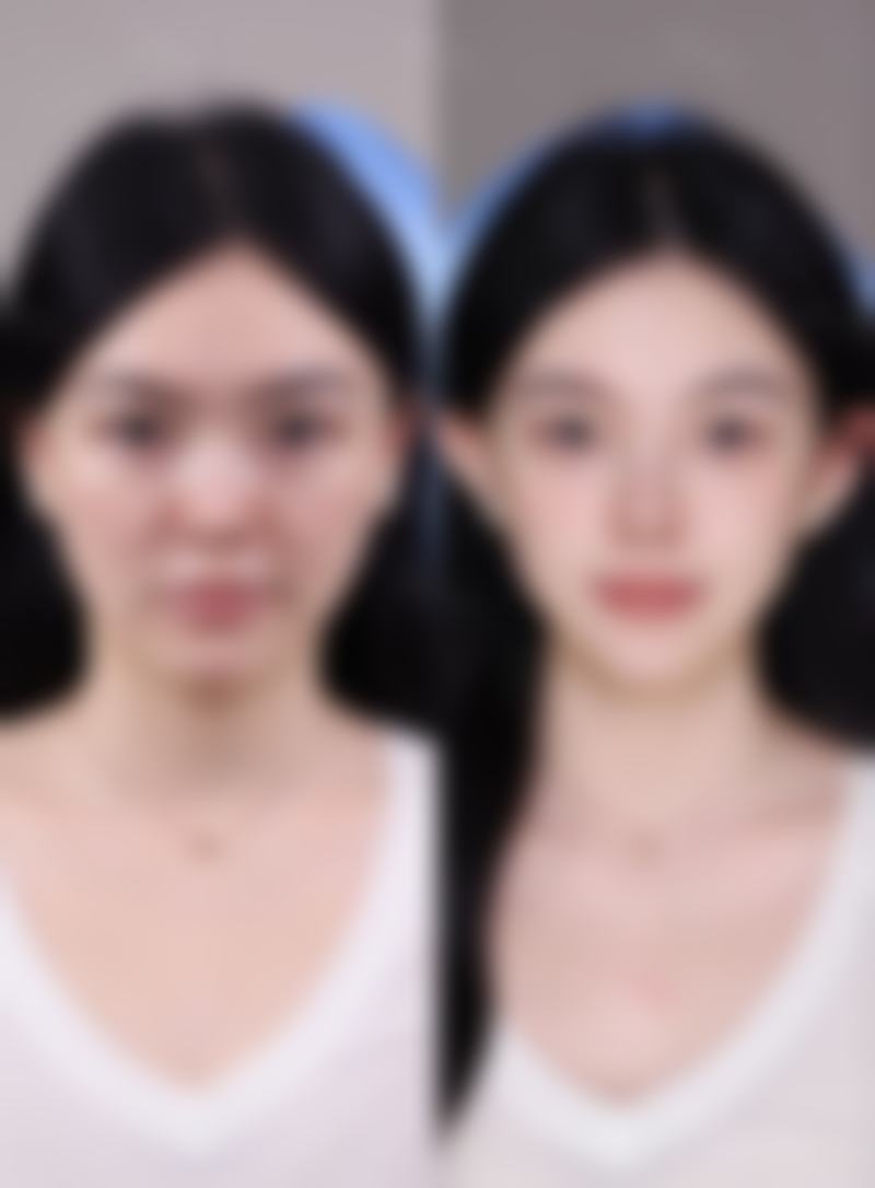 韩国进口除皱品牌