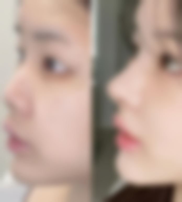 术后修复注意事项