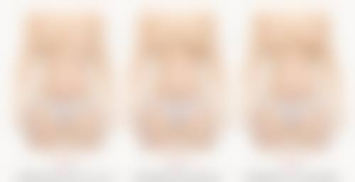 额头太高能毛发种植吗 - 图片与视频展示