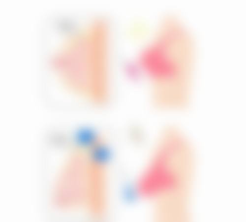 怎么厚唇变薄整形？这3种医美方法超靠谱，让你轻松拥有自然迷人薄唇，告别厚唇烦恼！ 