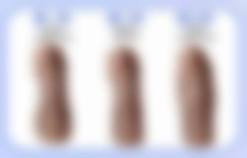 嘴唇特别厚怎么变薄？揭秘3种热门医美方法让你轻松拥有薄唇，自信展现迷人微笑！ 