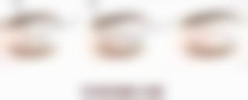 毛发种植后的修复时间