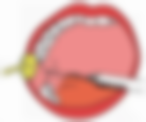 怎样让厚嘴唇变成薄嘴唇除了整容