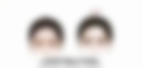 种植的头发还会脱落吗?