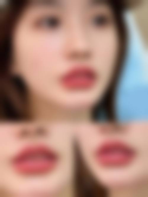 【西安辛西娅昕颜整形医院核心优势：】