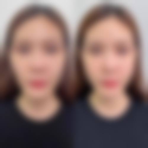 【无锡市第二人民医院整形美容科地址：】