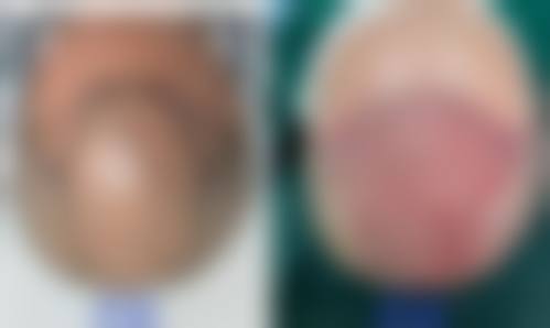 【南京江宁鼻祖整形医院是正规的吗?】