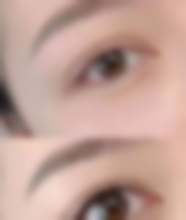 种植头发的危害和后遗症