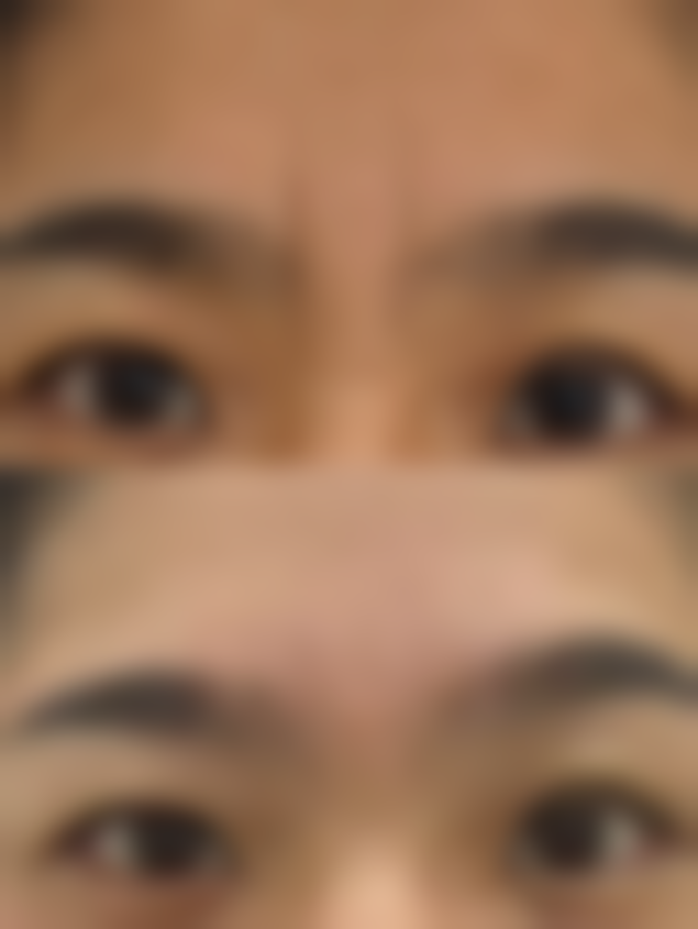 避免刺激：预防唇部炎症性肿胀