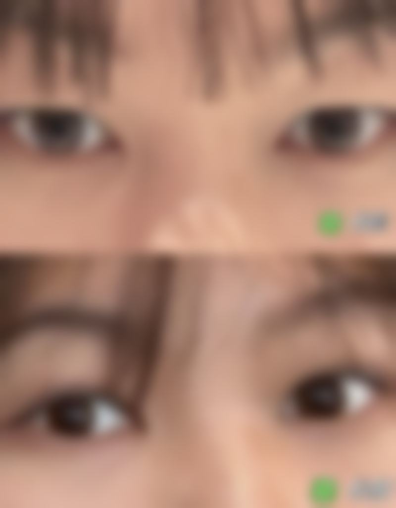 【上海悦美整形医疗美容诊所参考价格表:】