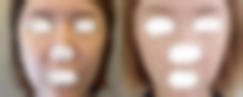 【韩国体美人吸脂中 心医生名单：】