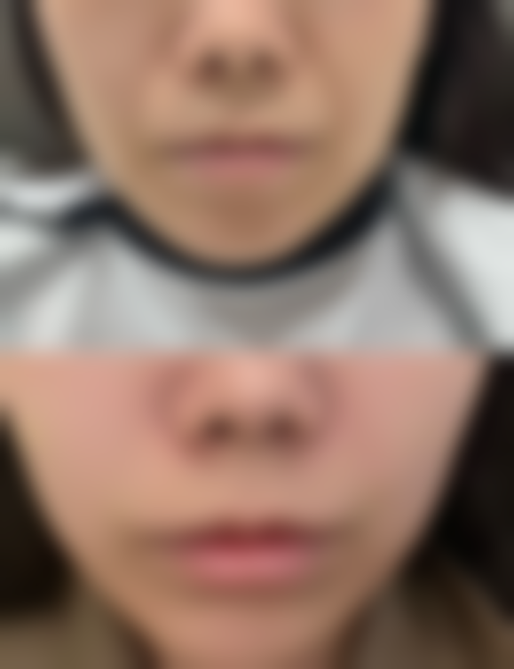 【上海悦美整形医疗美容诊所是正规的吗?】