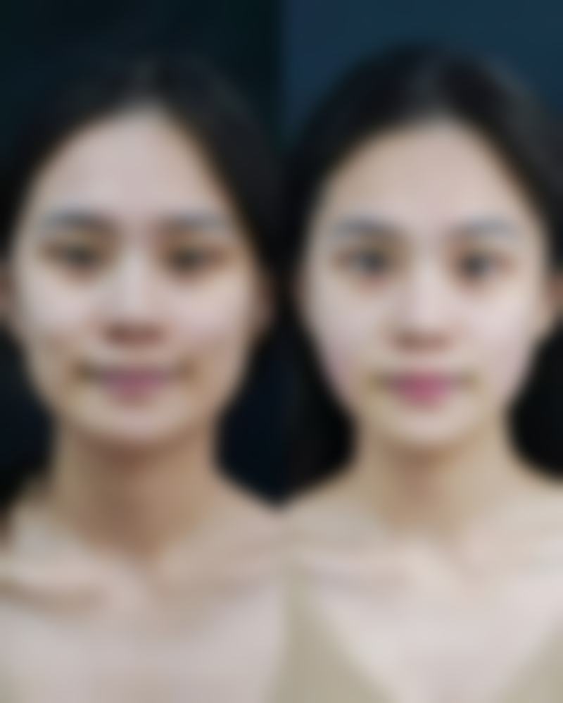 【西安辛西娅昕颜整形医院特色项目：】