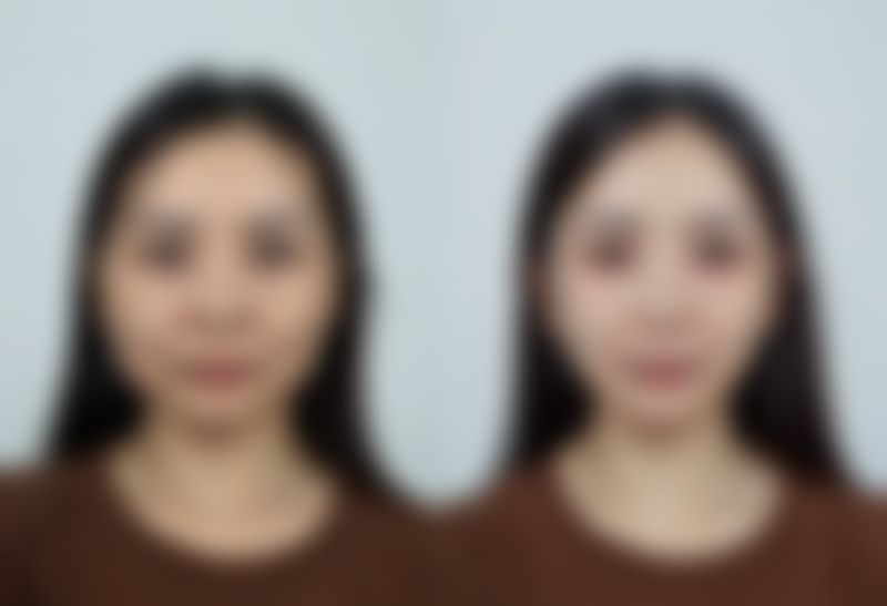 【资阳伊之美整形美容医院是正规的吗?】