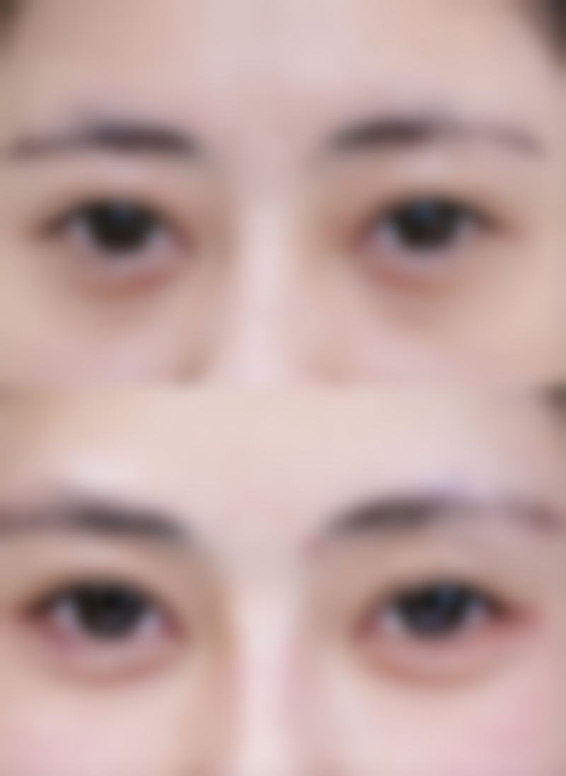 【韩国体美人吸脂中 心患者口碑评价：】