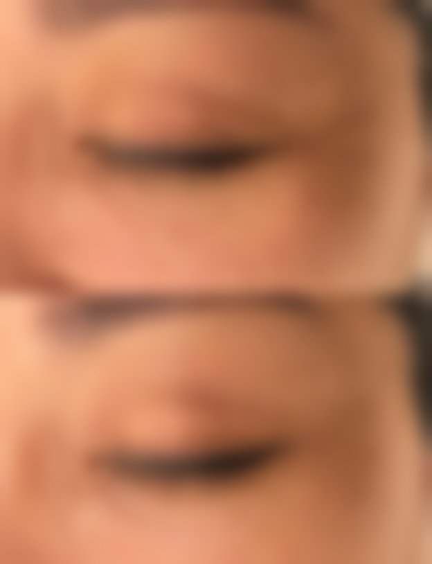 【无锡市第二人民医院整形美容科怎么预约挂号?】