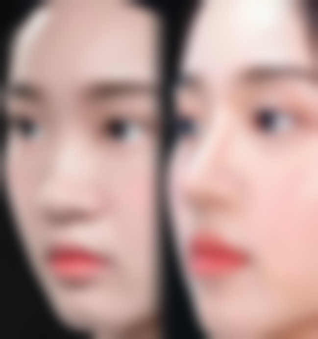 种植的头发长出来为什么是弯曲的?