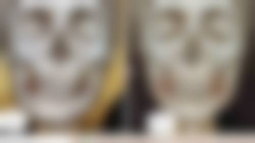 第一次做瘦脸针,需要做哪些术前准备和禁忌事项?