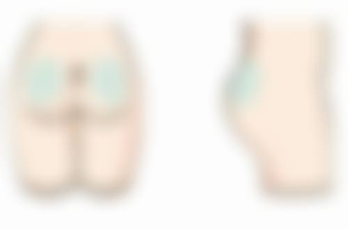 打瘦脸针咬肌会修复到原位吗