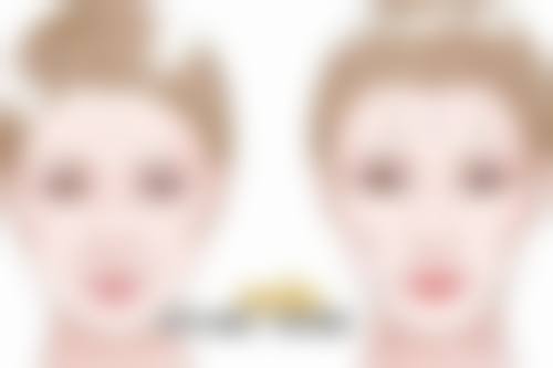 脸上打除皱针有成效吗