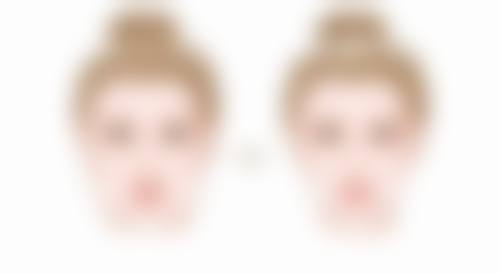 如何判断自己的修复情况