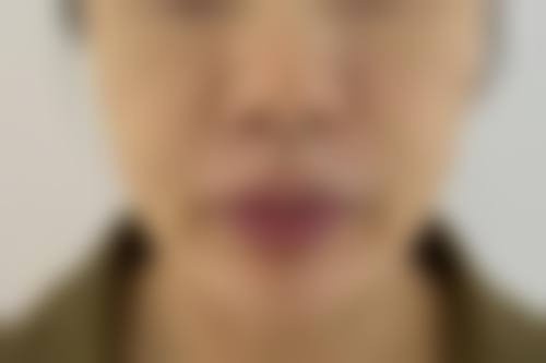 【青岛海妙华美整形医院是正规的吗?】