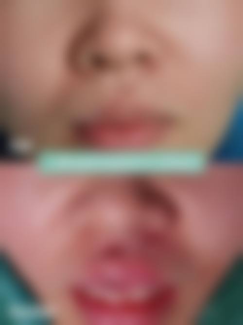 【青岛海妙华美整形医院诊疗设备：】