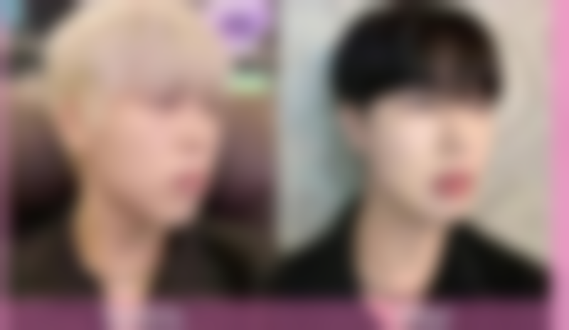 脸上有皱纹打针除皱针好不好？揭秘3大优势，90%的人打完都说好，效果显著还安全！ 