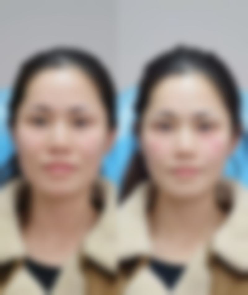 【重庆脸璞医疗美容门诊部诊疗设备:】