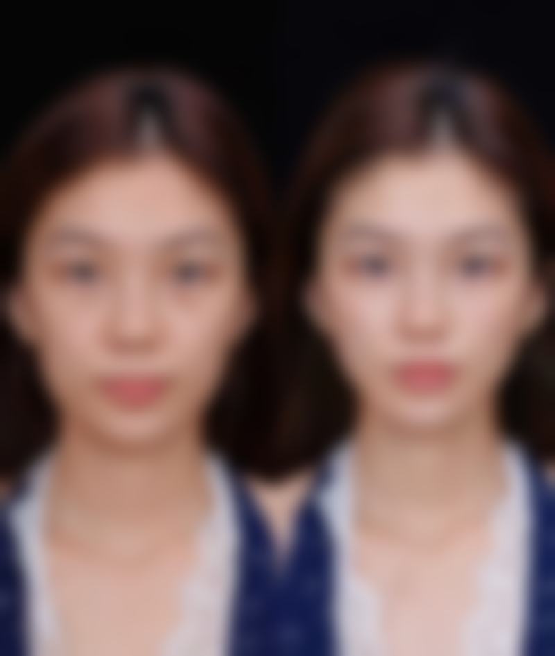 【东莞媄媄医疗美容门诊部患者口碑评价：】