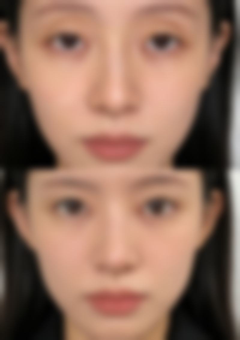 【天津倍丽医疗美容诊所参考价格表：】