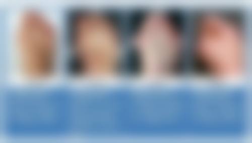 长期注射瘦脸针的注意事项