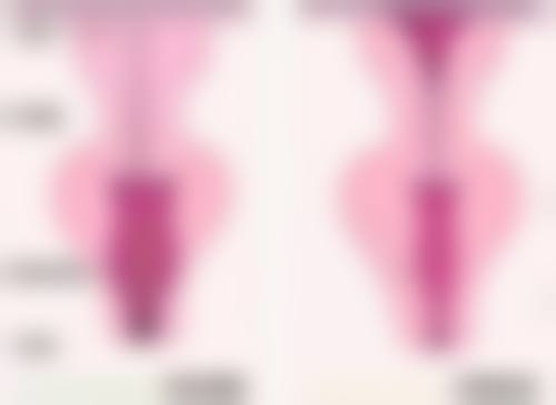 打完瘦脸针轮廓会有吗