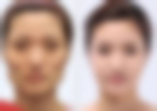 不同年龄段的注射注意事项