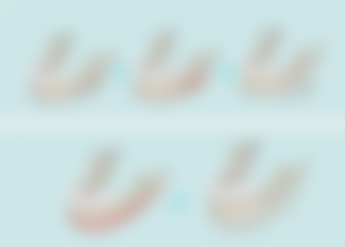 打完瘦脸针和轮廓针注意事项