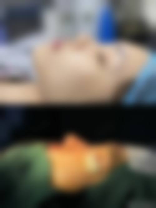 【深圳仙紫整形医院参考价格表：】