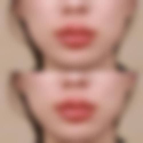 【郑州伊莱美医疗美容患者口碑评价:】