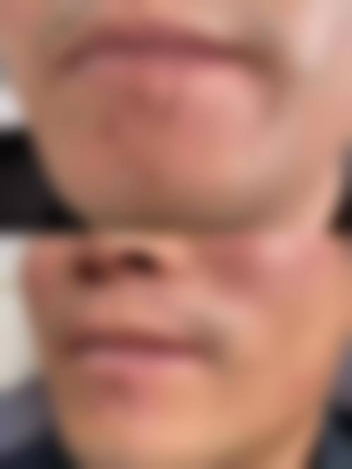 【南宁美丽星整形美容医院特色项目:】