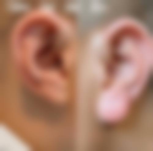 【杭州新城医院整形外科特色项目:】