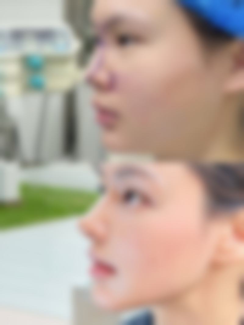 【唐山艾丽妮医疗美容诊所参考价格表:】