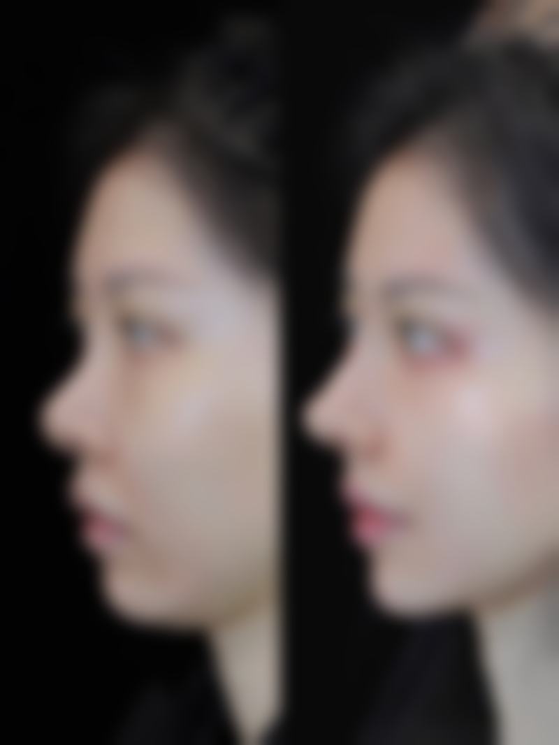 (二)提前沟通身体状况