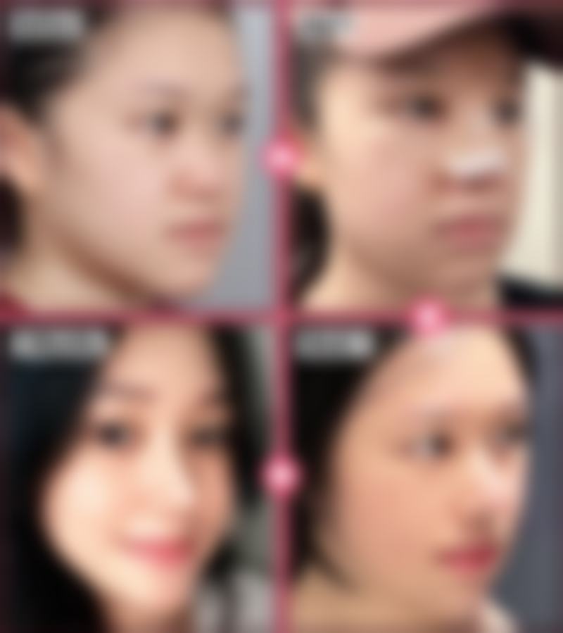 【深圳仙紫整形医院是正规的吗?】